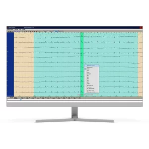 Изображение Суточное мониторирование ЭКГ Safe Heart System (SHS-24h)