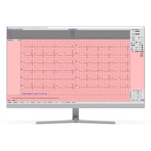 Изображение ЭКГ нагрузки Stress-12-Cardio