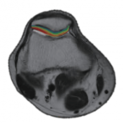 Изображение uMR 770 Магнитно-резонансный томограф UTX 3.0T MR