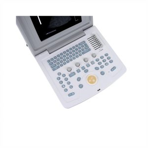 Изображение УЗИ сканер CMS600B3 (портативный)