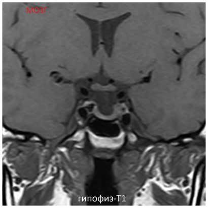 Фото SuperVAN 1,5T МРТ Изображение SuperVAN 1,5T МРТ