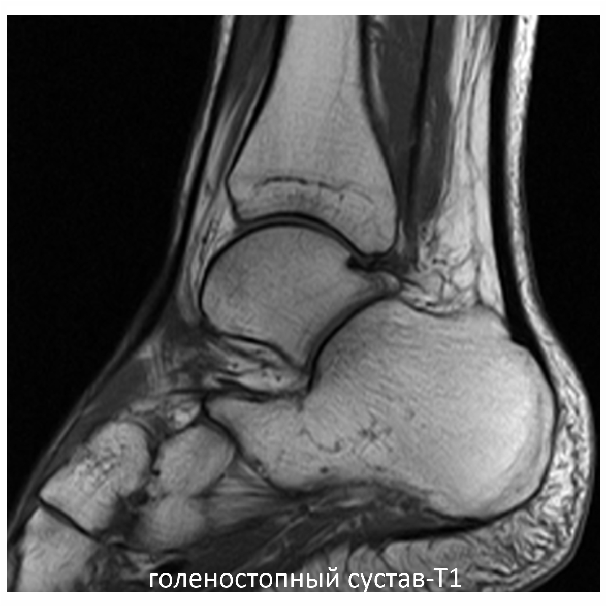 Фото SuperVAN 1,5T МРТ Изображение SuperVAN 1,5T МРТ