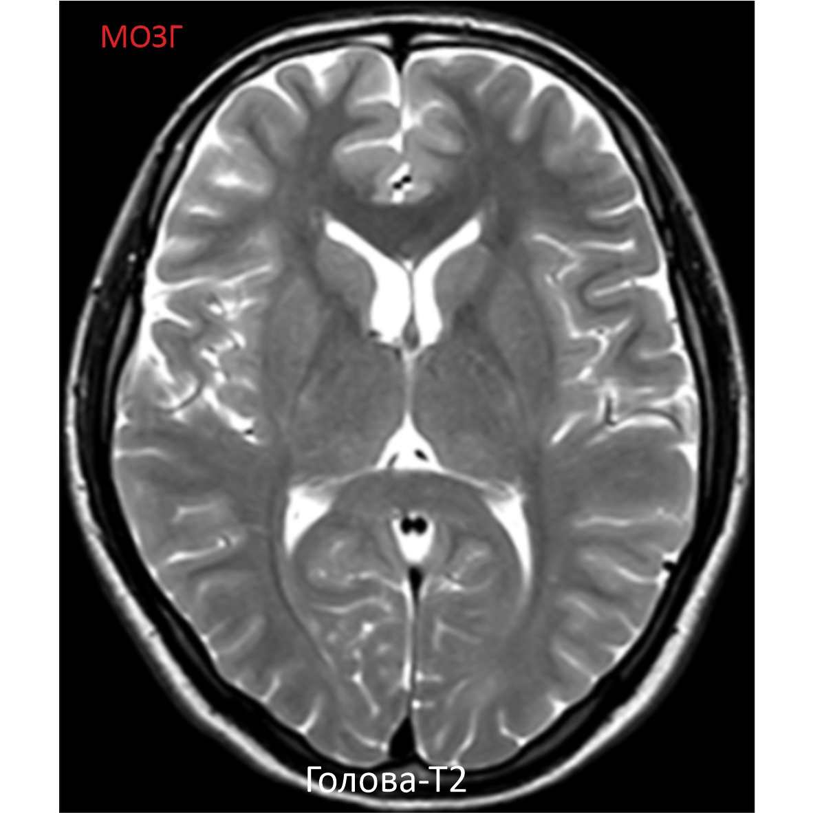 Фото SuperVAN 1,5T МРТ Изображение SuperVAN 1,5T МРТ