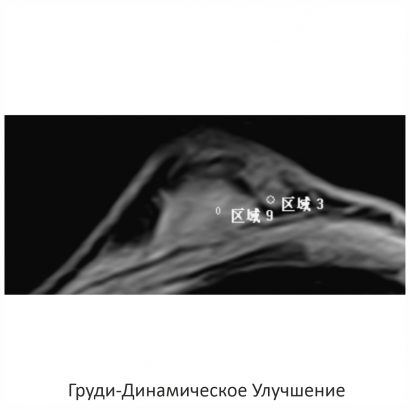 Фото SuperVAN 1,5T МРТ Изображение SuperVAN 1,5T МРТ