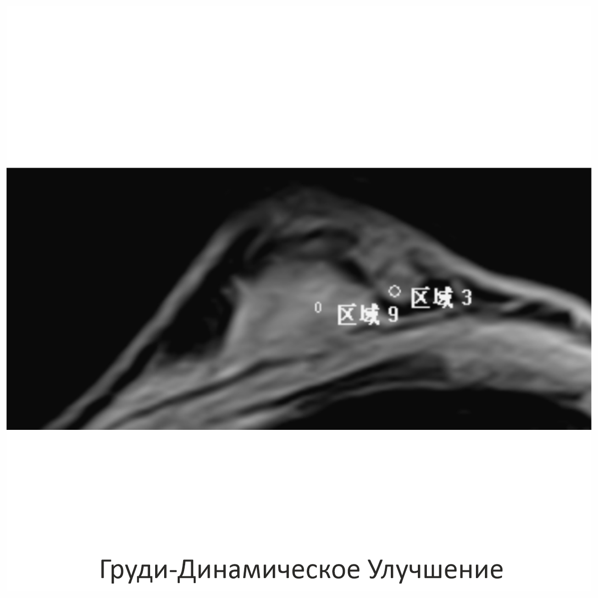 Фото SuperVAN 1,5T МРТ Изображение SuperVAN 1,5T МРТ