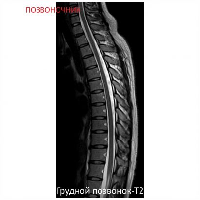 Фото SuperVAN 1,5T МРТ Изображение SuperVAN 1,5T МРТ