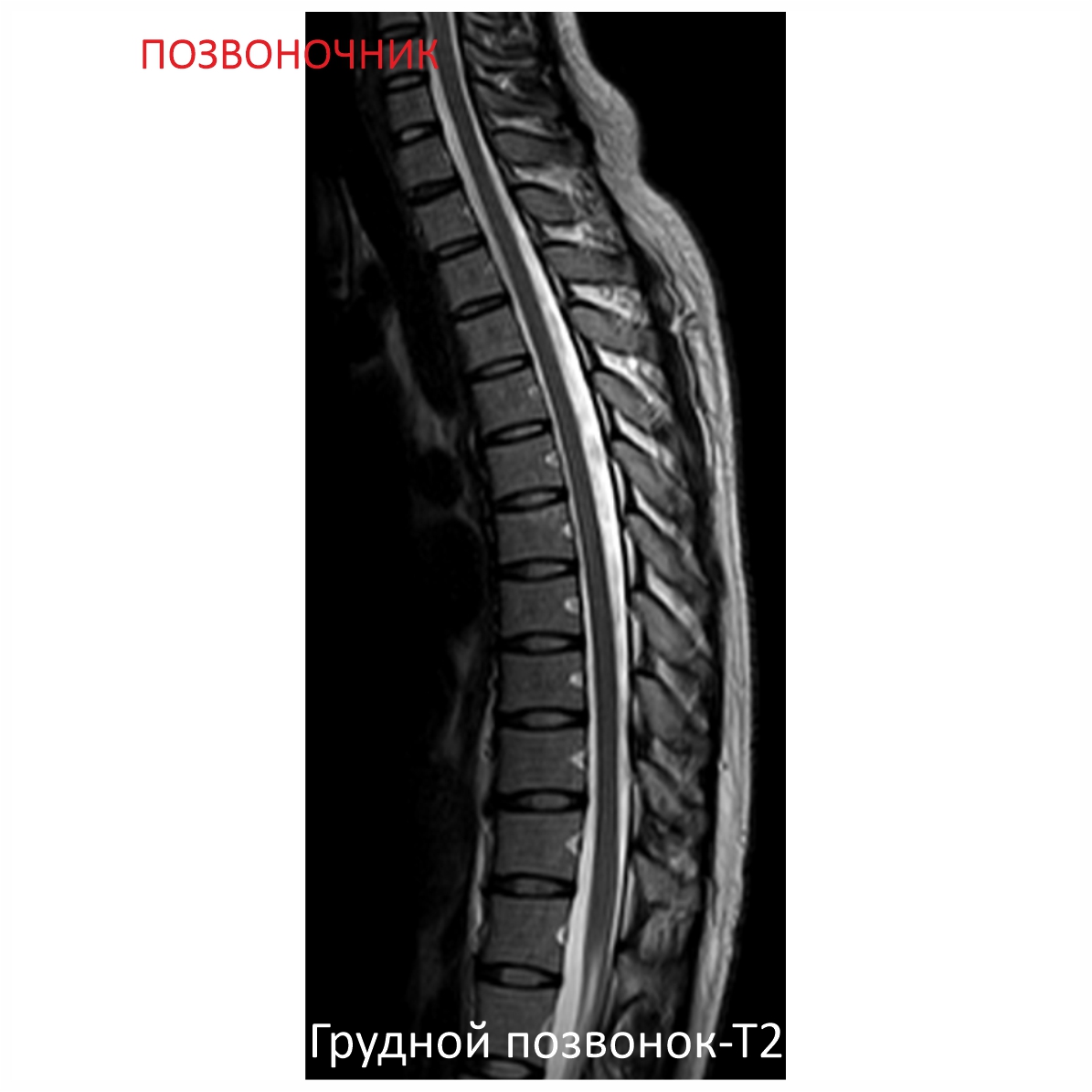 Фото SuperVAN 1,5T МРТ Изображение SuperVAN 1,5T МРТ