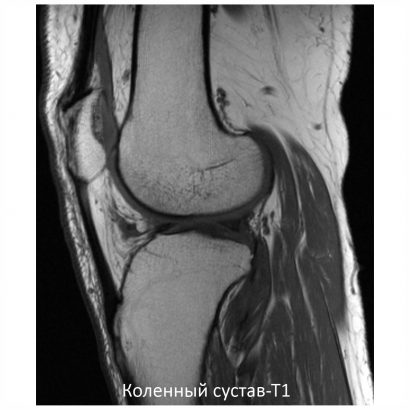 Фото SuperVAN 1,5T МРТ Изображение SuperVAN 1,5T МРТ