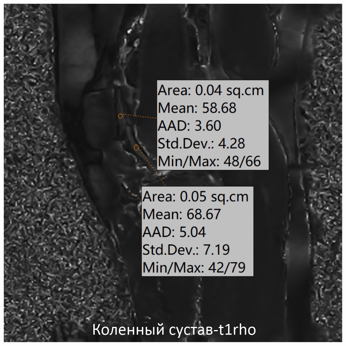 Фото SuperVAN 1,5T МРТ Изображение SuperVAN 1,5T МРТ