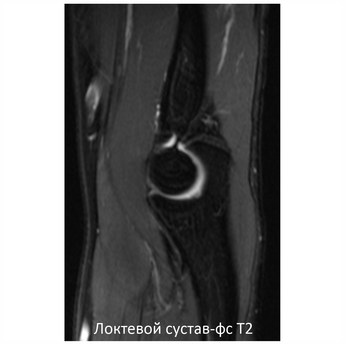 Фото SuperVAN 1,5T МРТ Изображение SuperVAN 1,5T МРТ