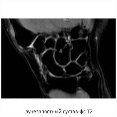 Фото SuperVAN 1,5T МРТ Изображение SuperVAN 1,5T МРТ