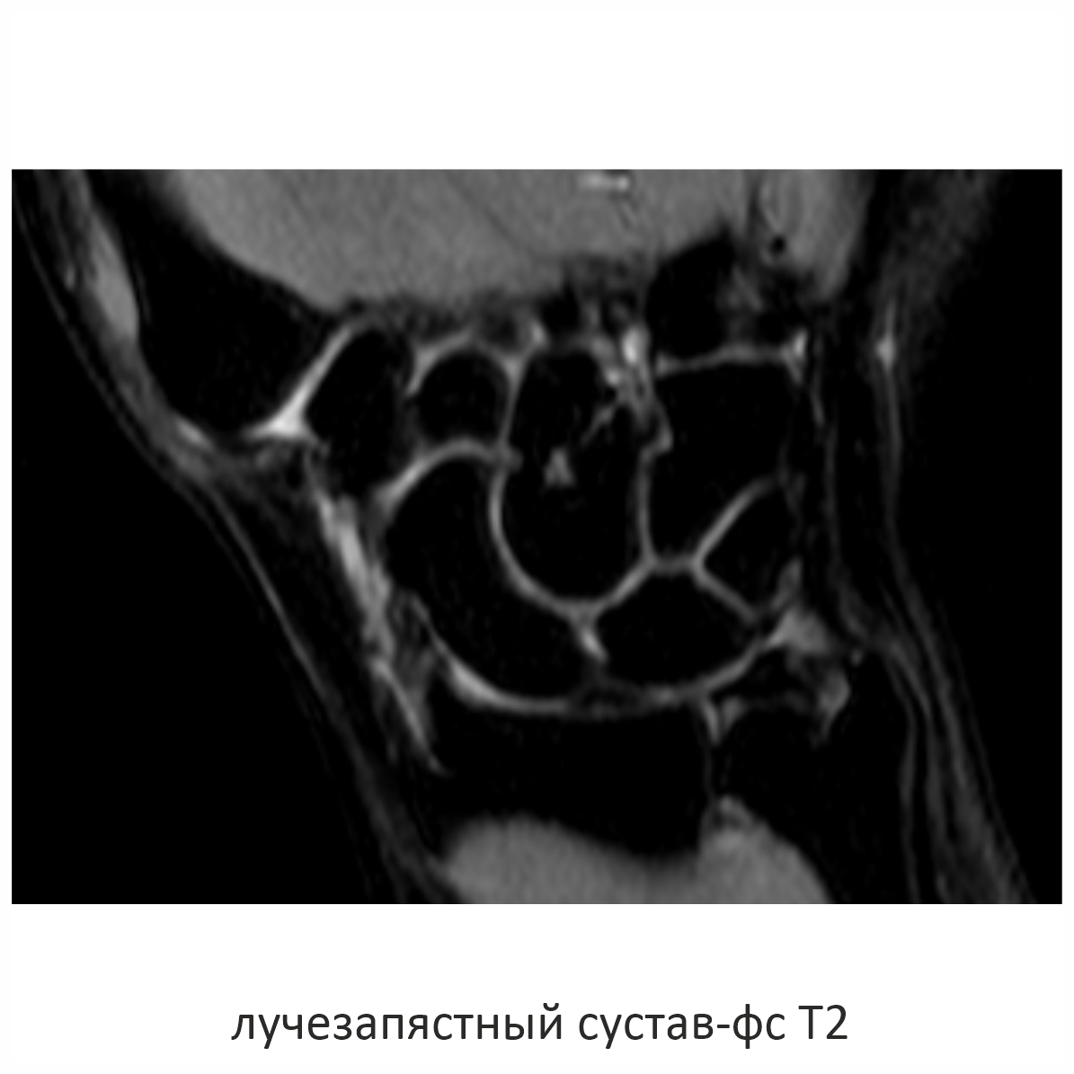 Фото SuperVAN 1,5T МРТ Изображение SuperVAN 1,5T МРТ