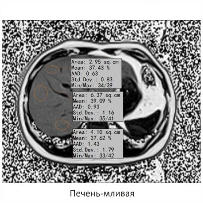 Фото SuperVAN 1,5T МРТ Изображение SuperVAN 1,5T МРТ