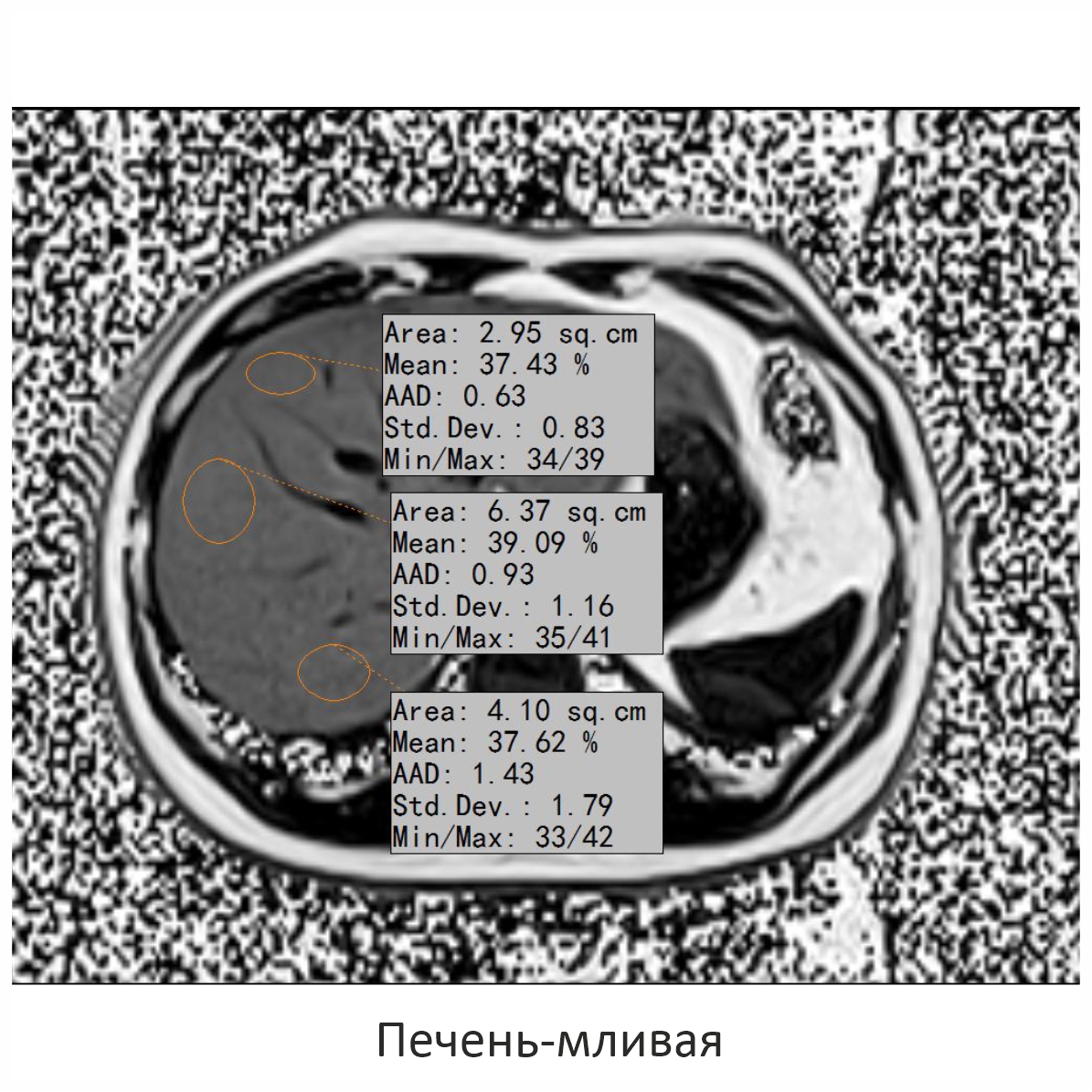 Фото SuperVAN 1,5T МРТ Изображение SuperVAN 1,5T МРТ