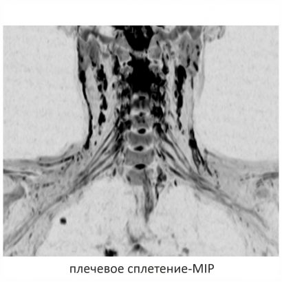 Фото SuperVAN 1,5T МРТ Изображение SuperVAN 1,5T МРТ