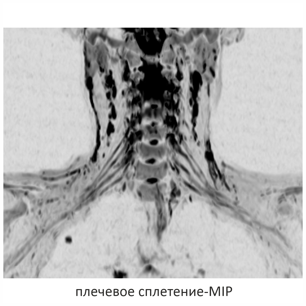 Фото SuperVAN 1,5T МРТ Изображение SuperVAN 1,5T МРТ