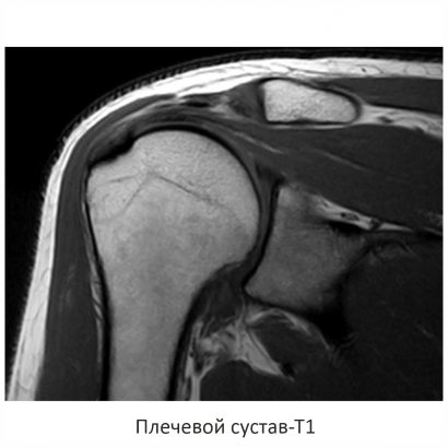 Фото SuperVAN 1,5T МРТ Изображение SuperVAN 1,5T МРТ