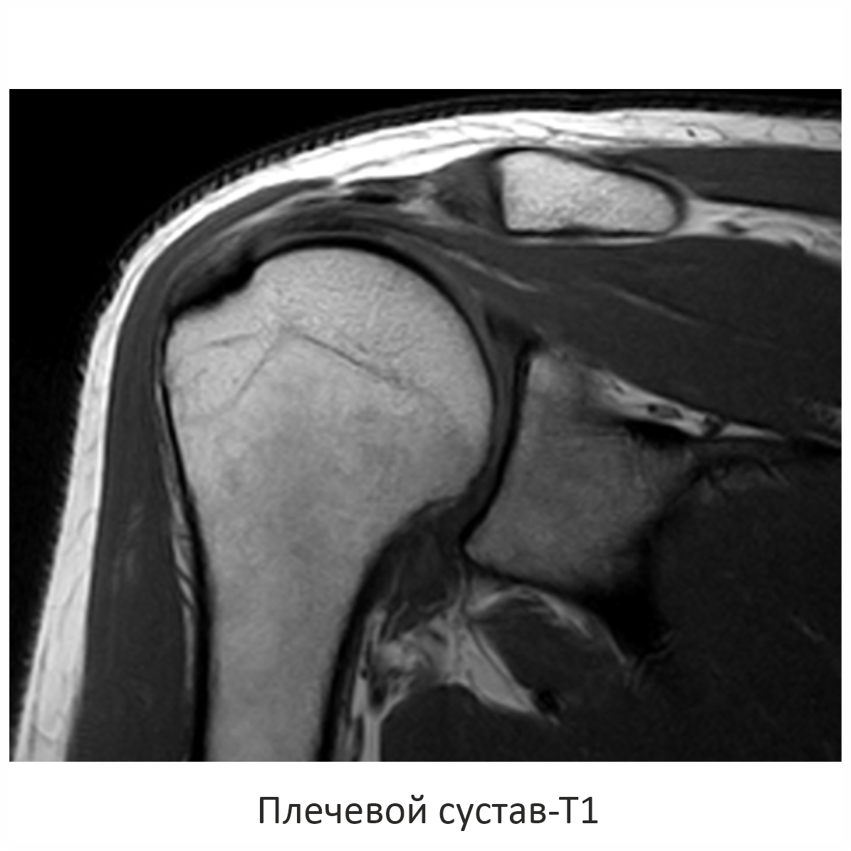 Фото SuperVAN 1,5T МРТ Изображение SuperVAN 1,5T МРТ