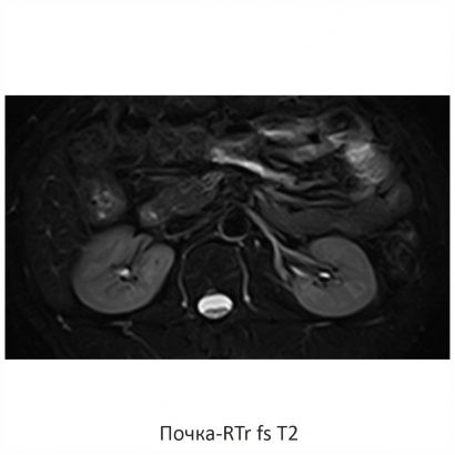 Фото SuperVAN 1,5T МРТ Изображение SuperVAN 1,5T МРТ