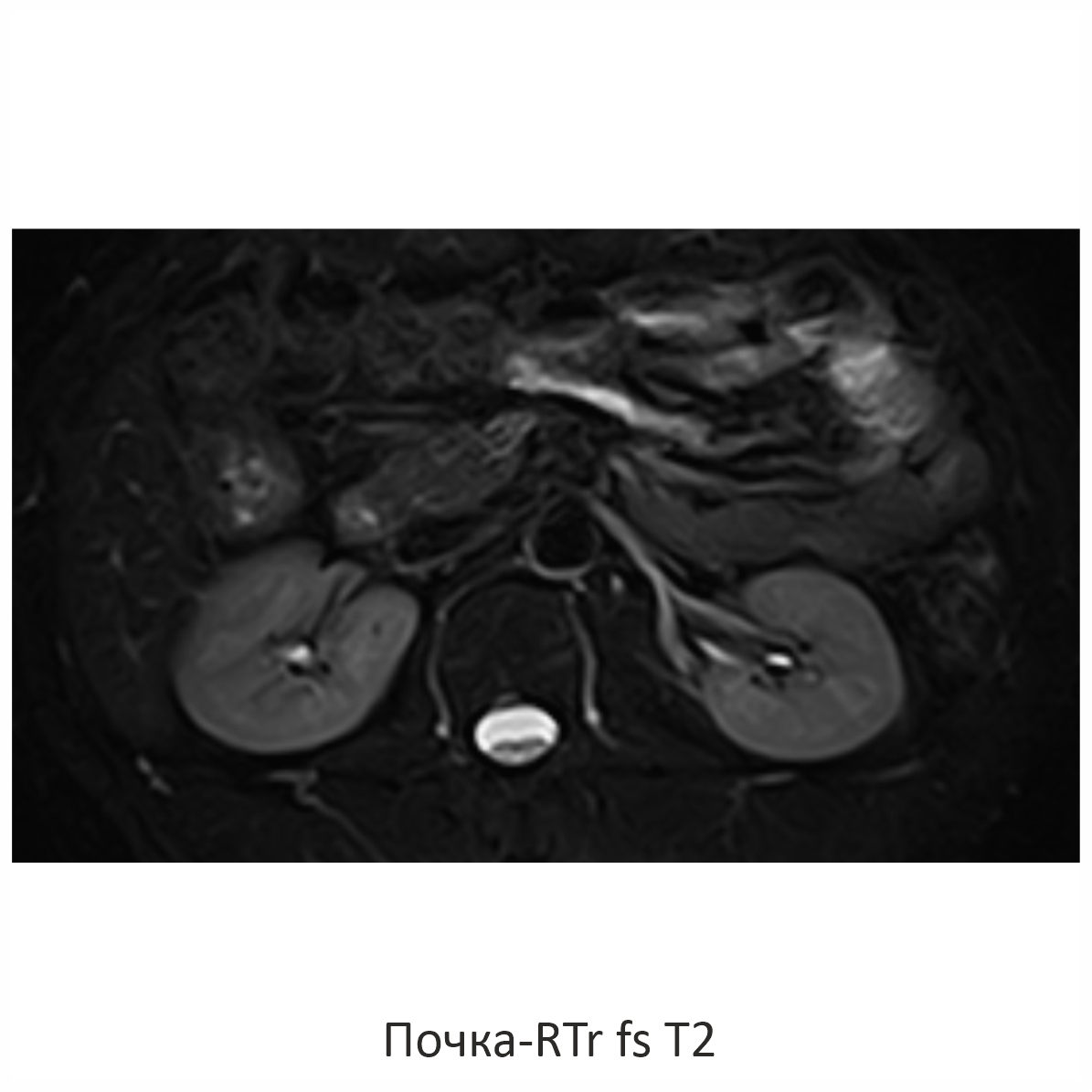 Фото SuperVAN 1,5T МРТ Изображение SuperVAN 1,5T МРТ