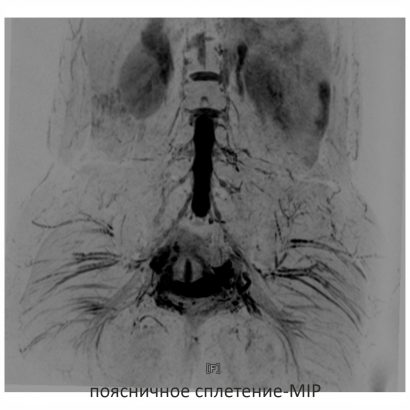 Фото SuperVAN 1,5T МРТ Изображение SuperVAN 1,5T МРТ