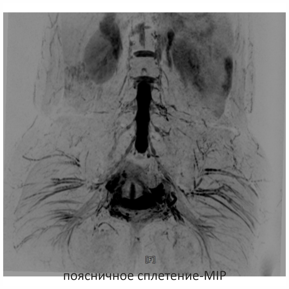 Фото SuperVAN 1,5T МРТ Изображение SuperVAN 1,5T МРТ
