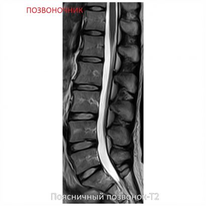 Фото SuperVAN 1,5T МРТ Изображение SuperVAN 1,5T МРТ