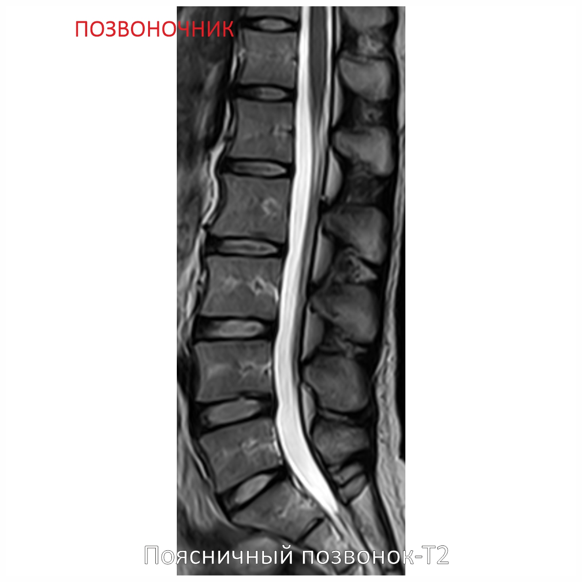 Фото SuperVAN 1,5T МРТ Изображение SuperVAN 1,5T МРТ