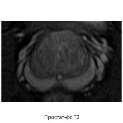 Фото SuperVAN 1,5T МРТ Изображение SuperVAN 1,5T МРТ