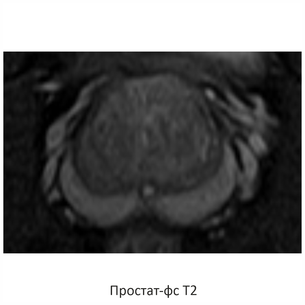 Фото SuperVAN 1,5T МРТ Изображение SuperVAN 1,5T МРТ