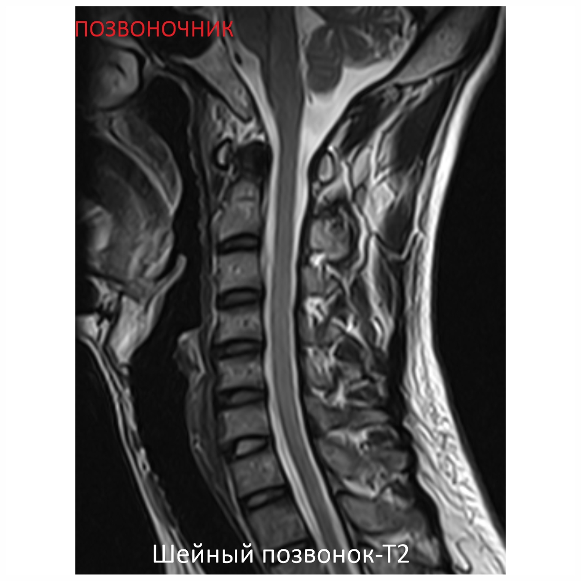 Фото SuperVAN 1,5T МРТ Изображение SuperVAN 1,5T МРТ