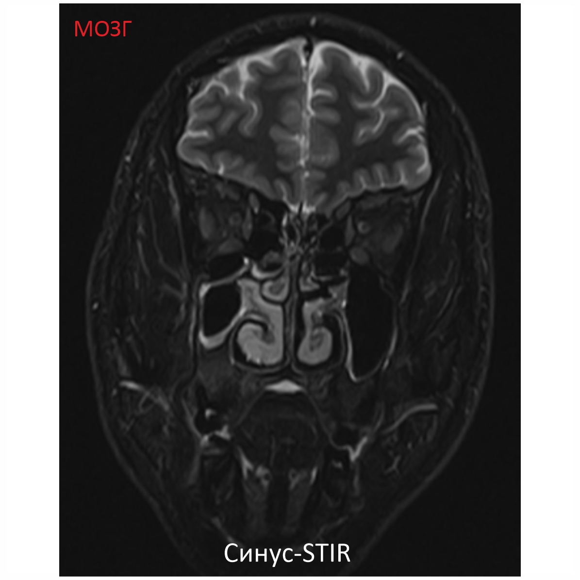 Фото SuperVAN 1,5T МРТ Изображение SuperVAN 1,5T МРТ