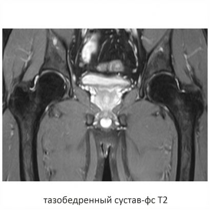 Фото SuperVAN 1,5T МРТ Изображение SuperVAN 1,5T МРТ