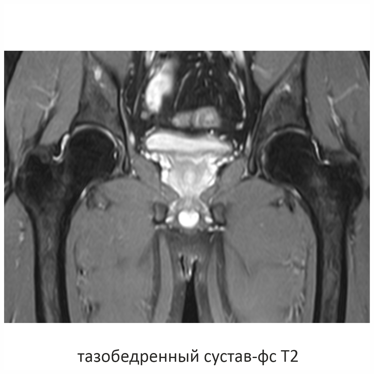 Фото SuperVAN 1,5T МРТ Изображение SuperVAN 1,5T МРТ