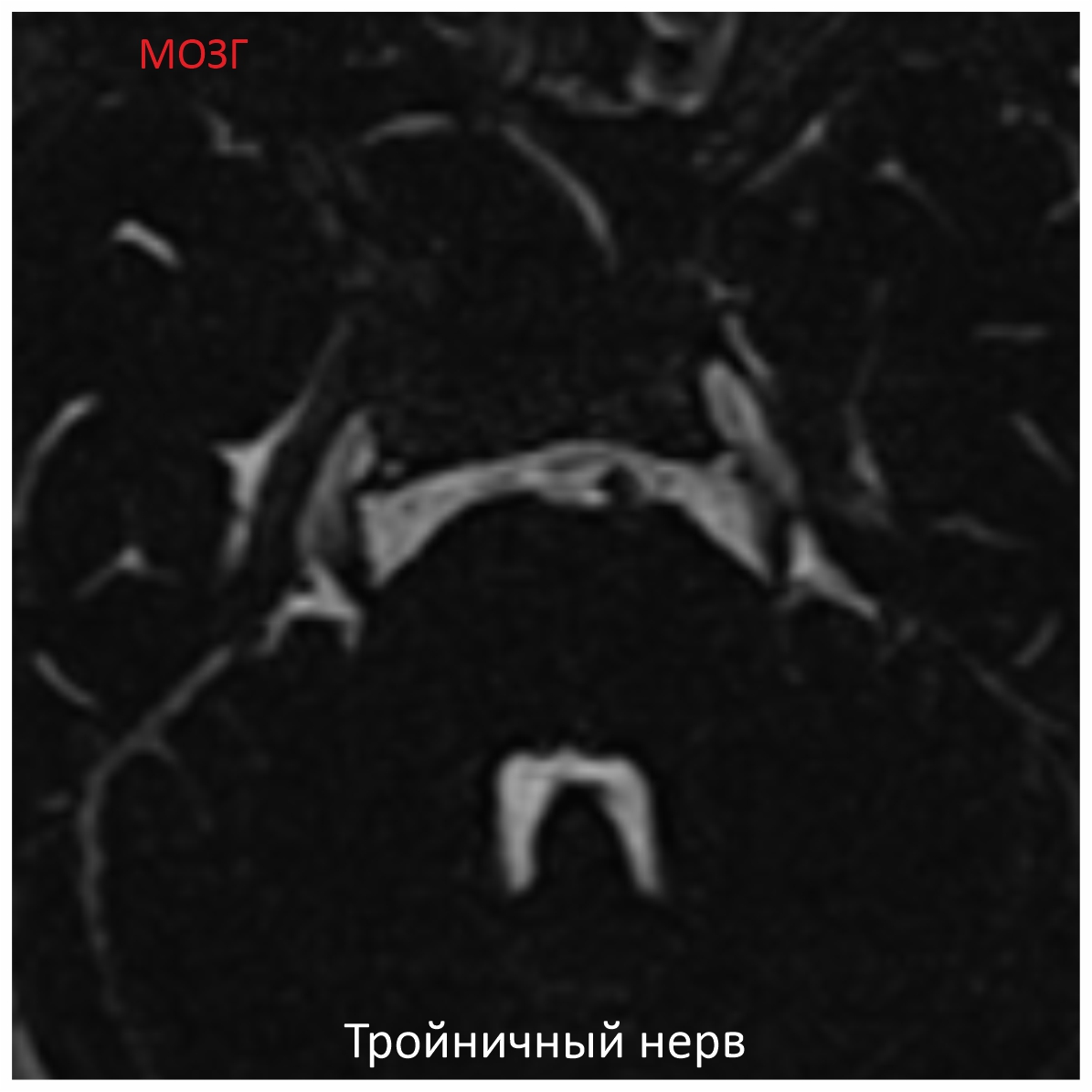 Фото SuperVAN 1,5T МРТ Изображение SuperVAN 1,5T МРТ