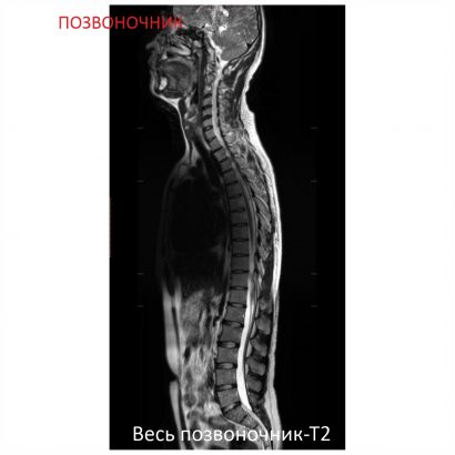 Фото SuperVAN 1,5T МРТ Изображение SuperVAN 1,5T МРТ