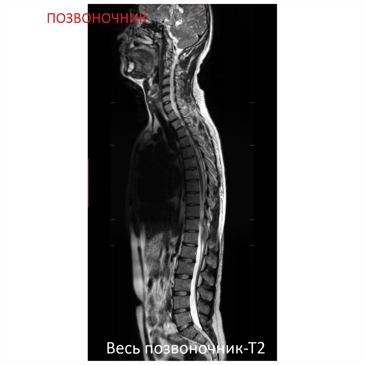 Фото SuperVAN 1,5T МРТ Изображение SuperVAN 1,5T МРТ