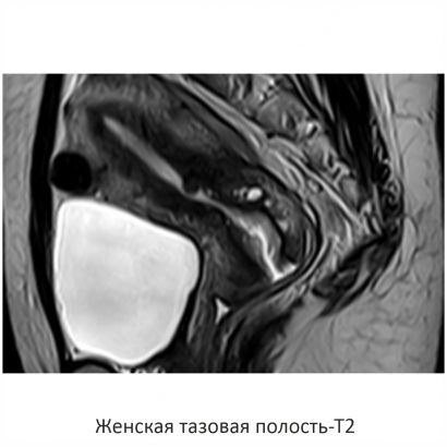 Фото SuperVAN 1,5T МРТ Изображение SuperVAN 1,5T МРТ