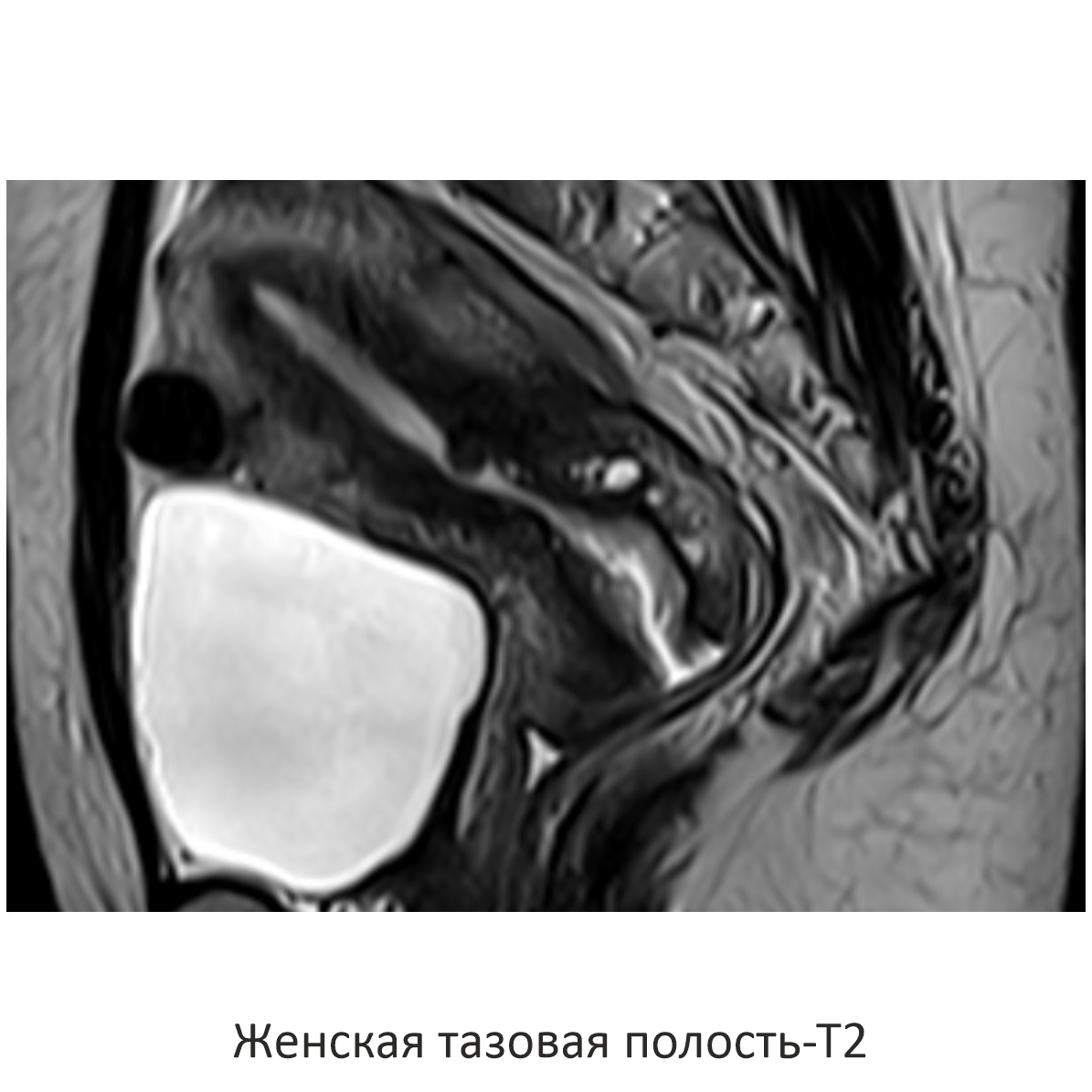 Фото SuperVAN 1,5T МРТ Изображение SuperVAN 1,5T МРТ