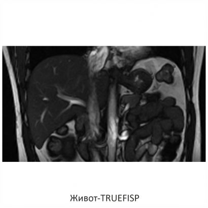 Фото SuperVAN 1,5T МРТ Изображение SuperVAN 1,5T МРТ