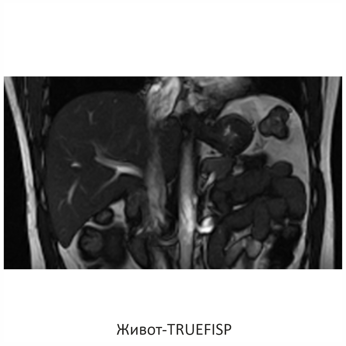 Фото SuperVAN 1,5T МРТ Изображение SuperVAN 1,5T МРТ