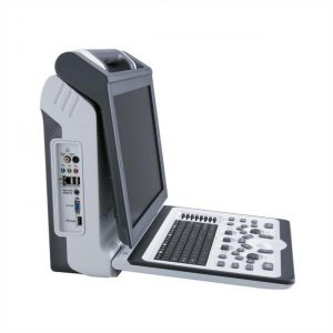 Изображение УЗИ аппарат Apogee 2100