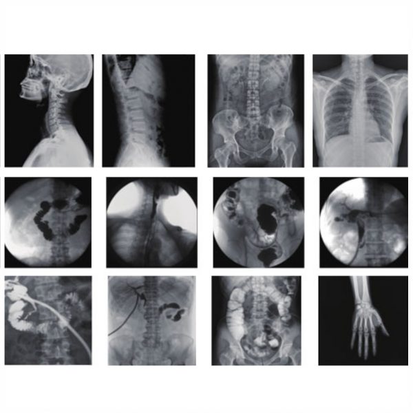 Изображение Система рентгеноскопии PLD5500B