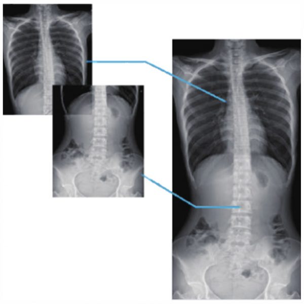 Изображение Система рентгеноскопии PLD9600A