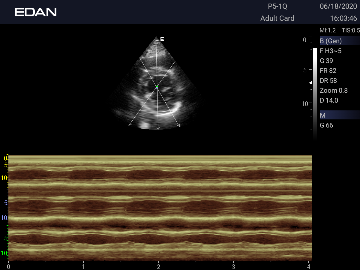 Изображение Ультразвуковая диагностическая система Acclarix LX3