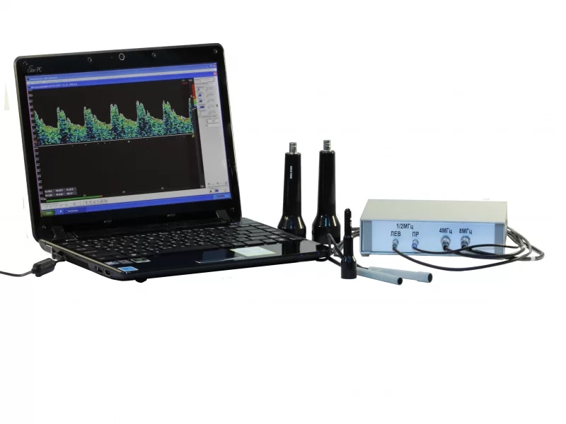 Изображение Допплер + эхоэнцефалограф Комплексмед исполнение 1.3 с ноутбуком