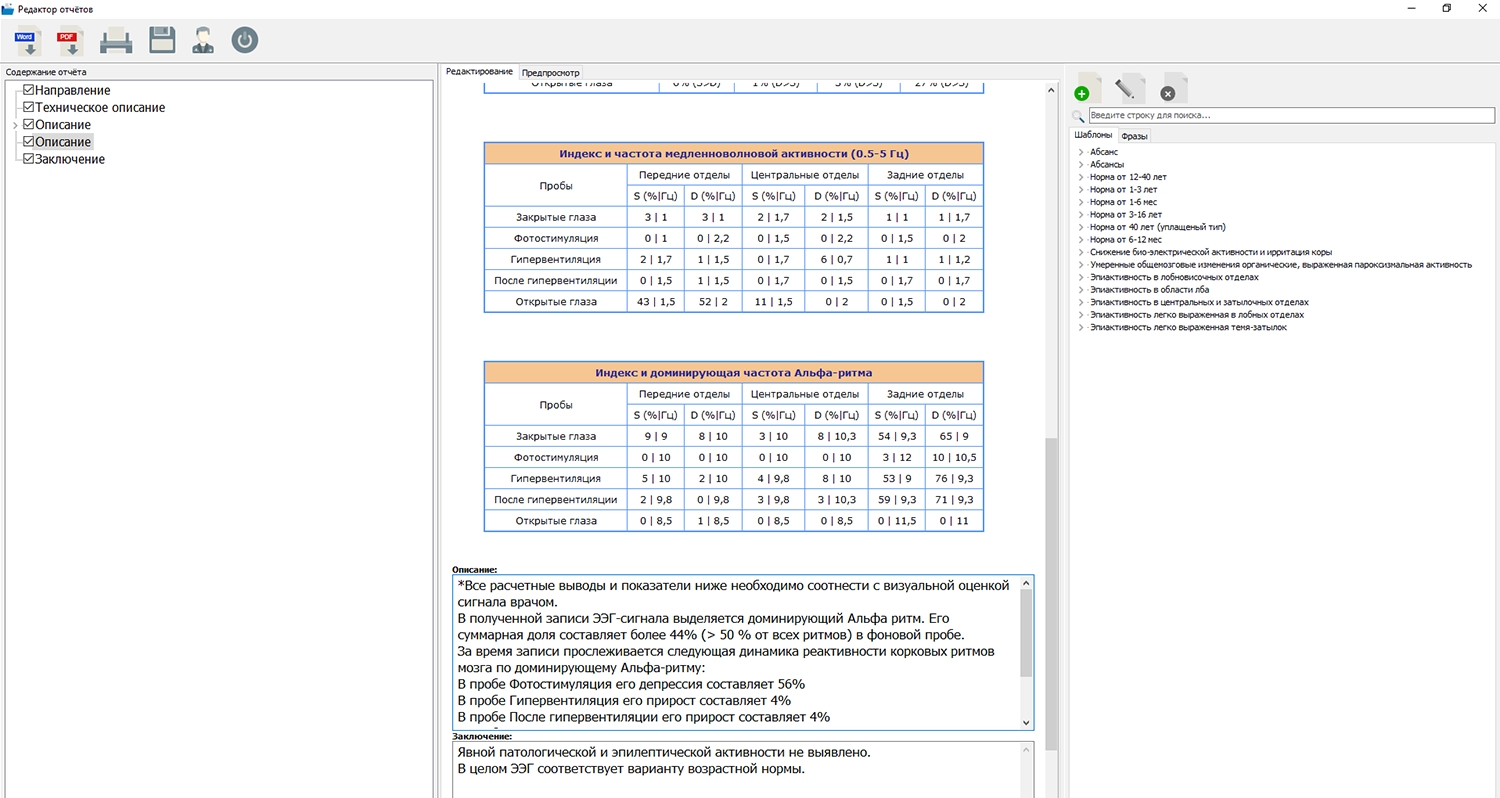 Изображение Электроэнцефалограф Компакт-Нейро 21 Канала (ЭЭГ)