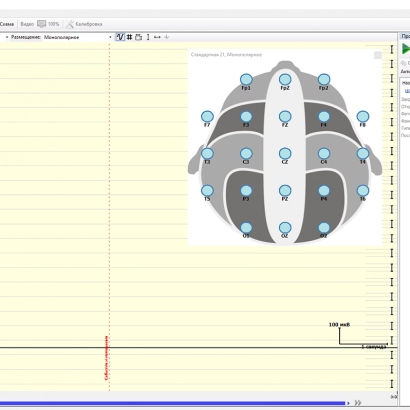 Изображение Компакт-Нейро 24 Канала с Видеомониторингом (ЭЭГ)