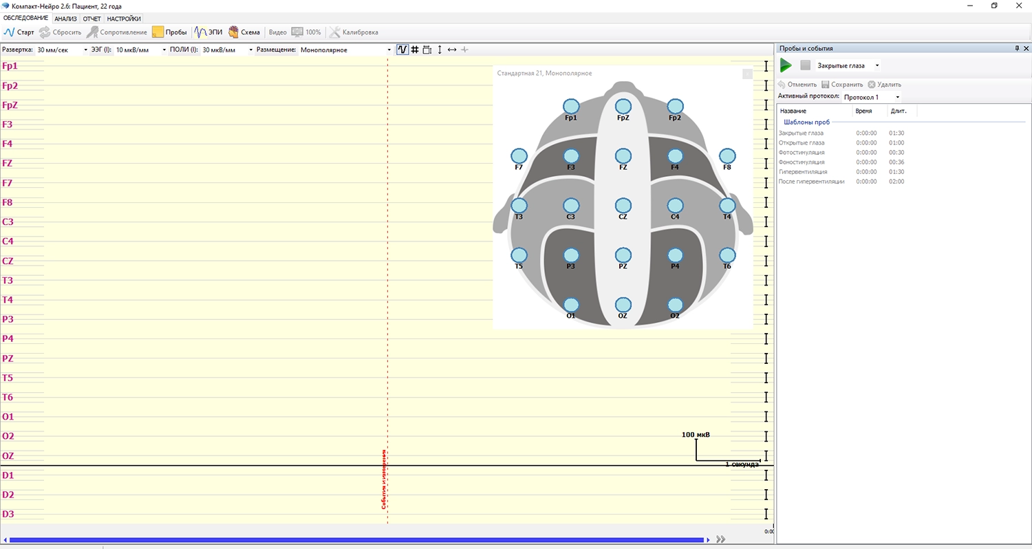 Изображение Электроэнцефалограф Компакт-Нейро 21 Канала (ЭЭГ)