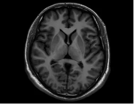 Изображение uMR 588 Магнитно-резонансный томограф UCS 1.5T МР